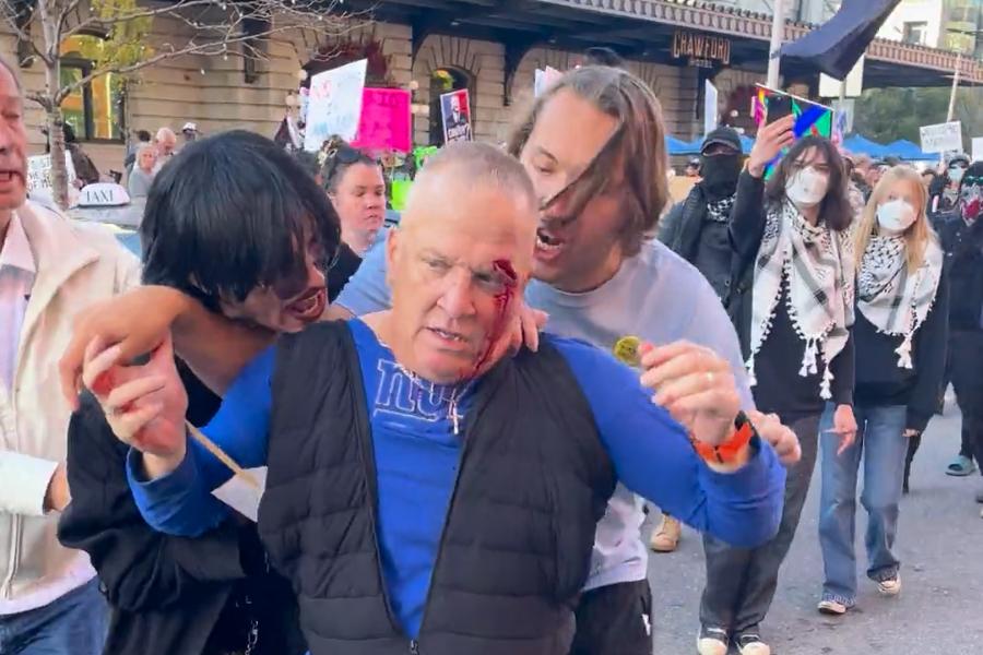 man with blood on face after No Kings protest altercation