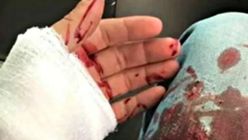 Joshua Witt’s Self-Stabbing, Neo-Nazis and Risks of Social Media