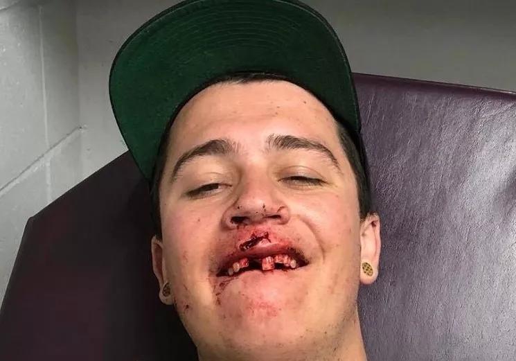 Readers: Denver Jam-Band Concerts Are Violent