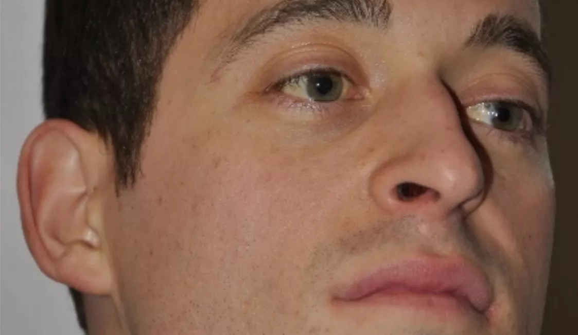 Claim: Arvada Cop Brutally Clobbered Suspect a Month After On-Duty Shooting