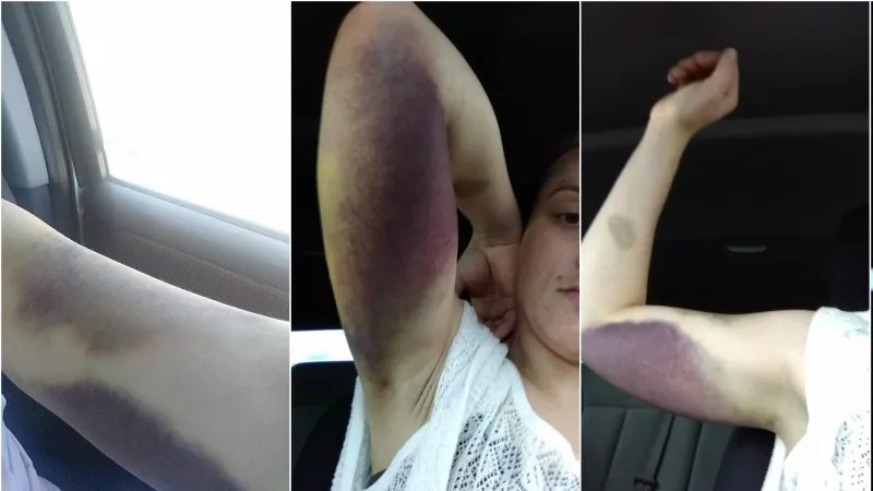 Why Fort Collins Paid $450K to Two Women Roughed Up by Cops