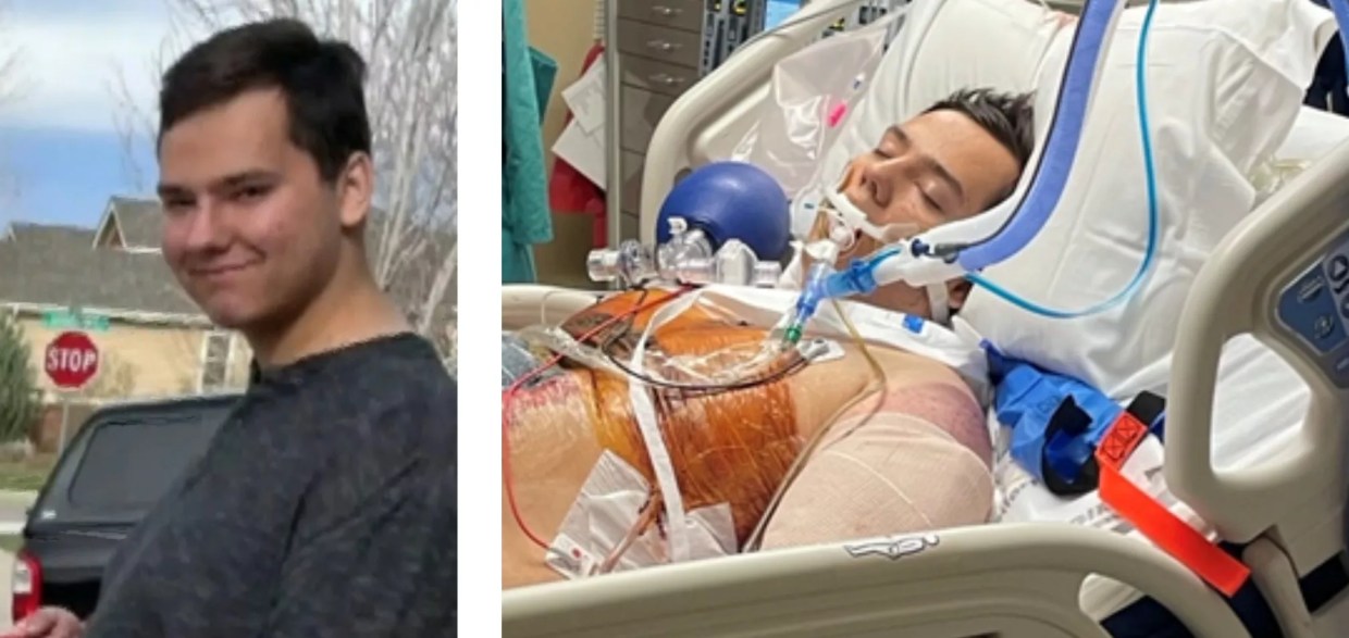 Remembering Alex Domina, Teen Killed by Cop During Mental Health Crisis