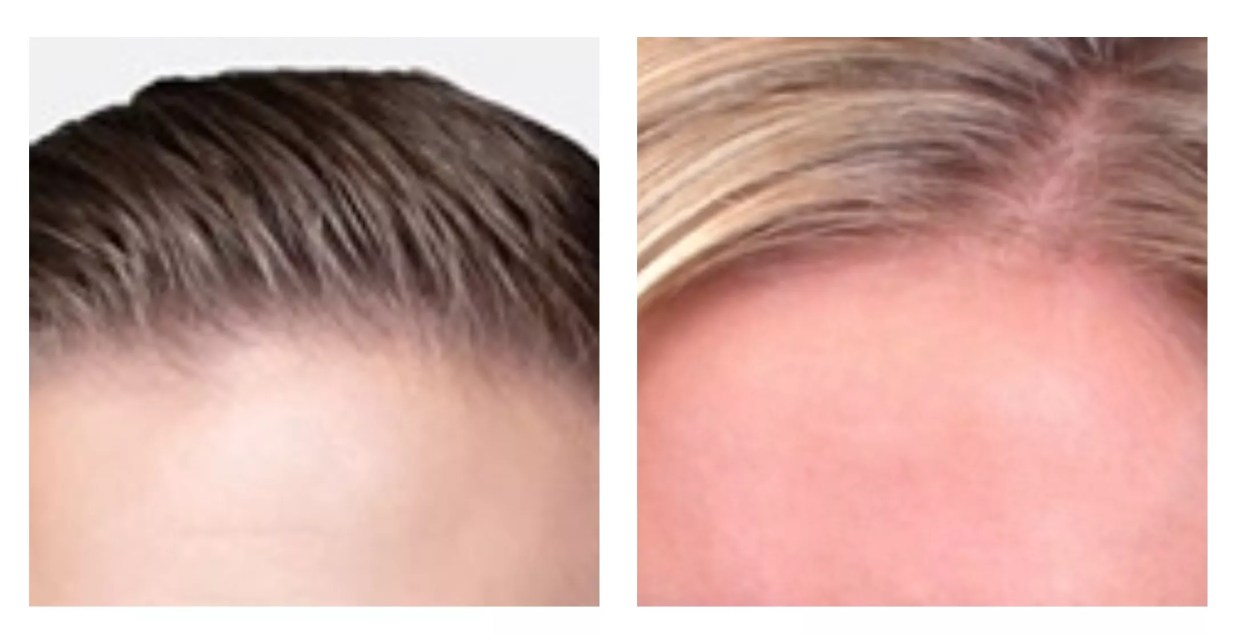 Best Hair on Denver TV Personalities