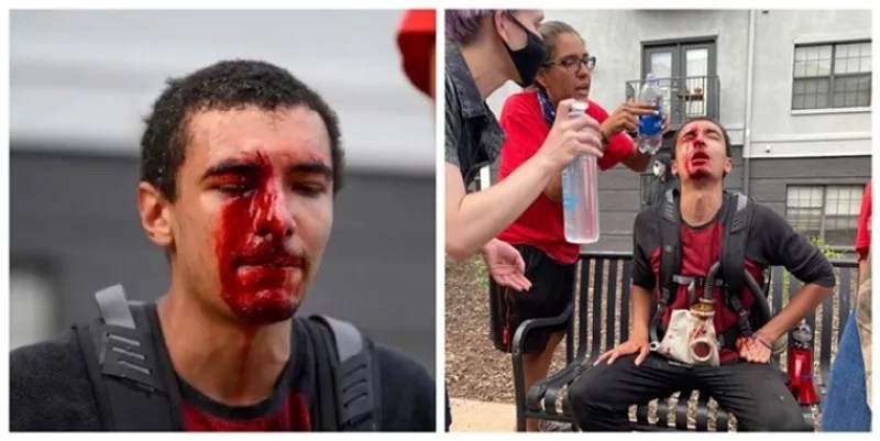 Lawsuit Time Bomb That Could Explode on Denver’s Next Mayor