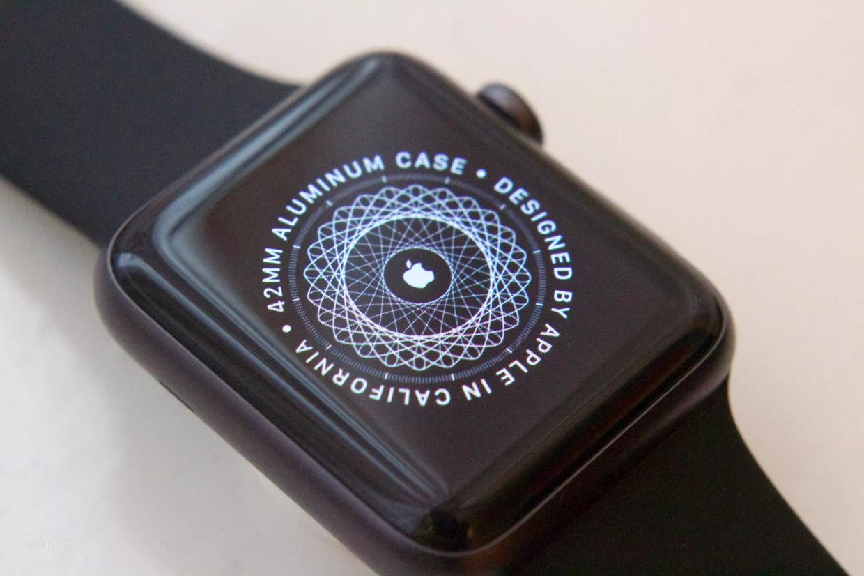 An Apple Watch